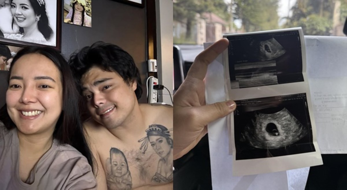 Rosmar dalawang buwang buntis; sinugod sa ER dahil sa spotting