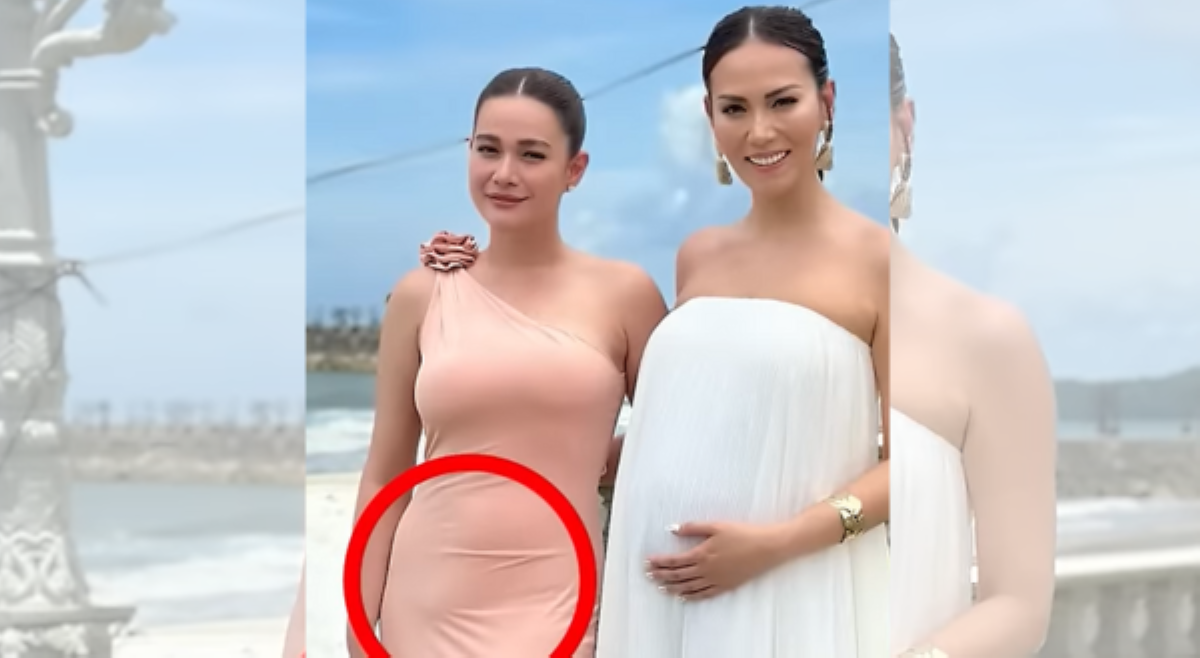 Bukol sa tiyan ni Bea Alonzo, inuurirat