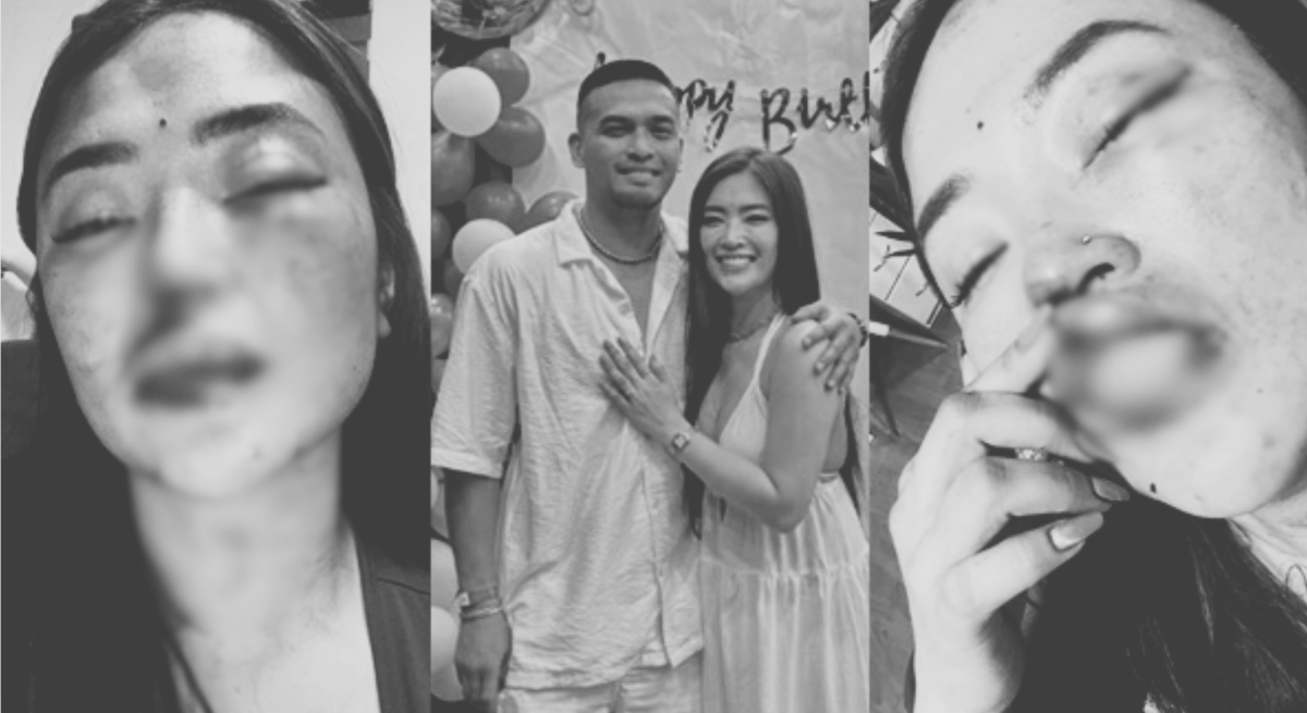 'Papakulong kita!' Ex ni Karla Estrada, nambugbog ng jowa?