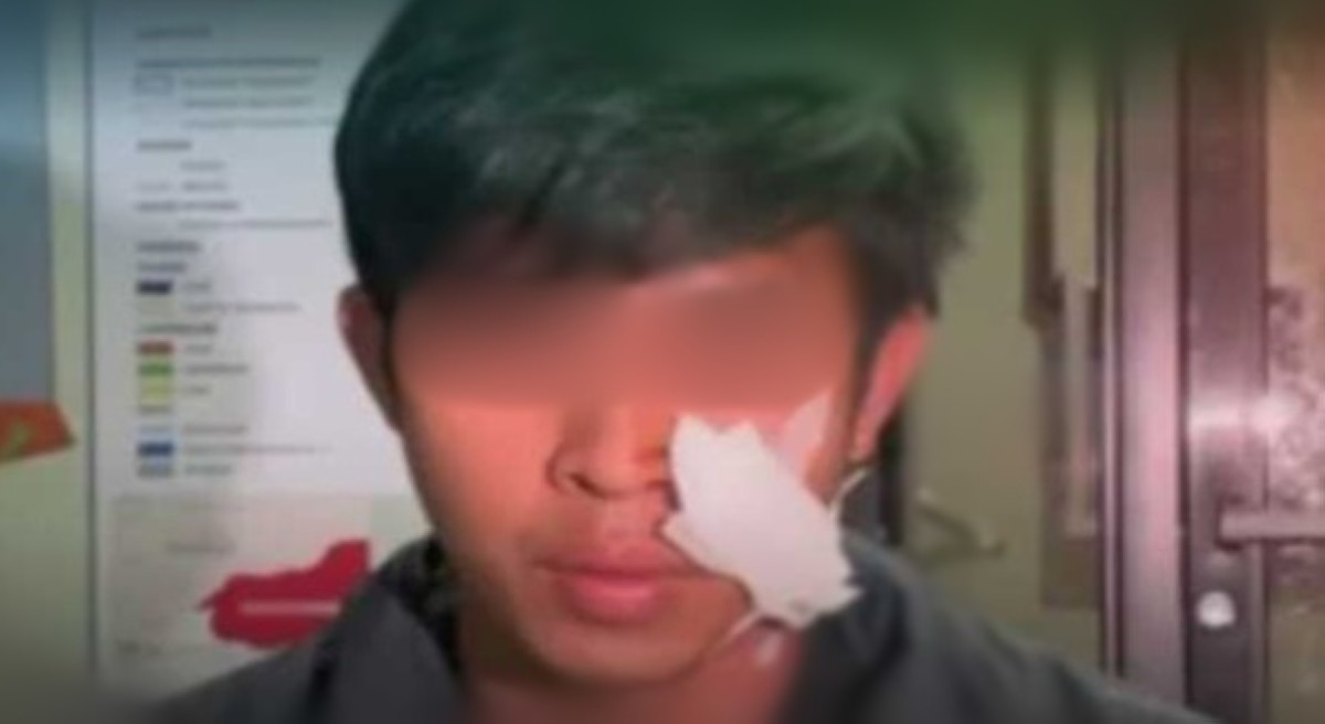 Lalaking bibili lang ng ulam, nasaksak sa mukha