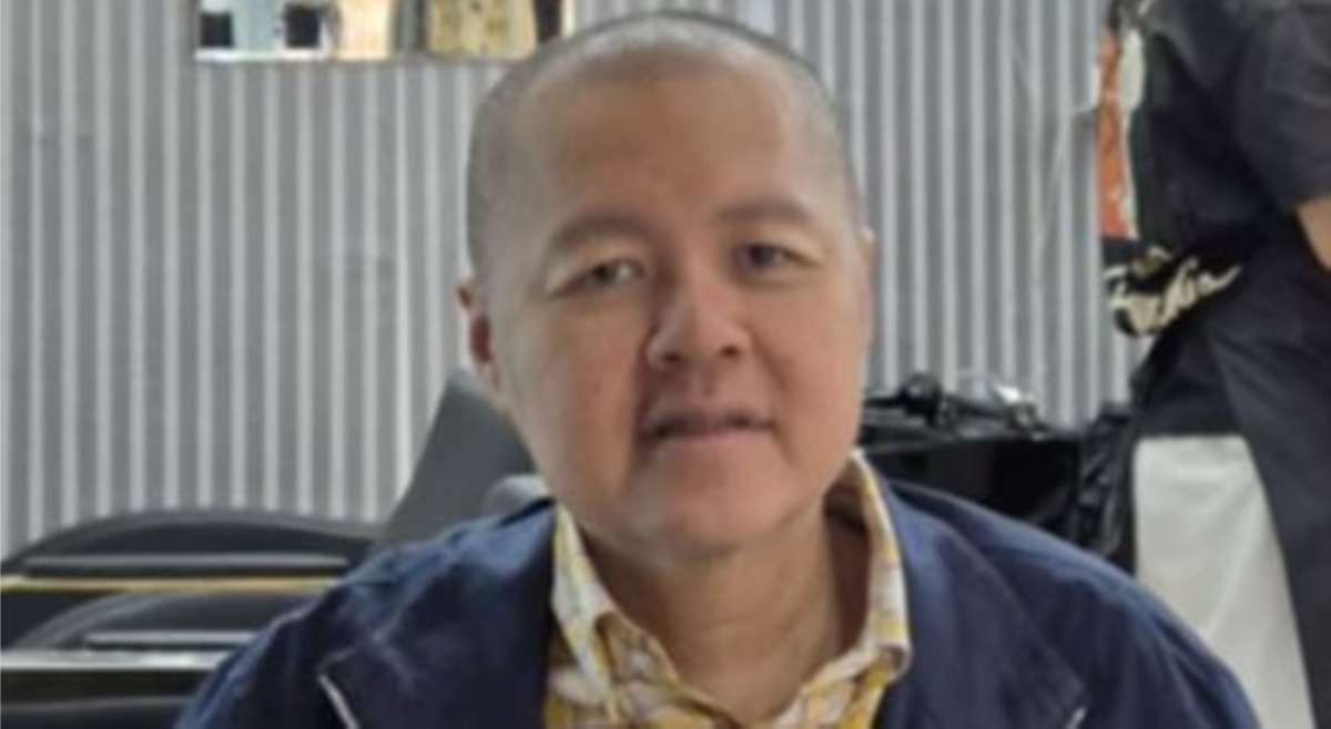 Doc Willie Ong, unti-unti nang tinutubuan ng buhok