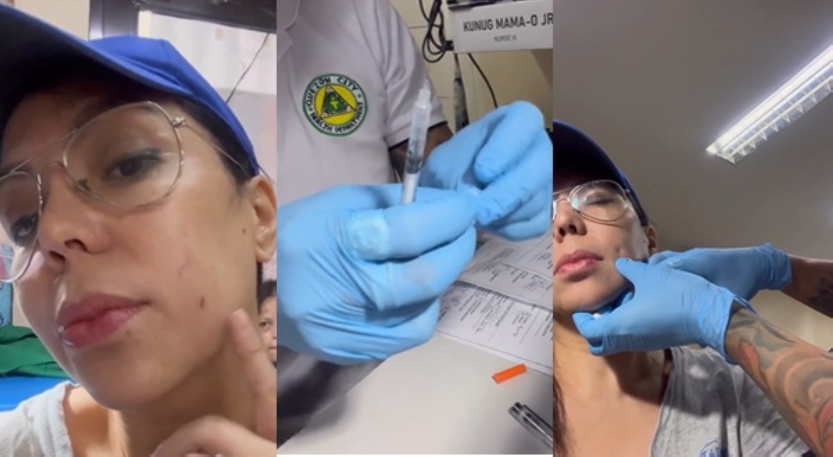 Alma sinakmal ng alagang aso; ibinahagi natutuhan tungkol sa anti-rabies shots
