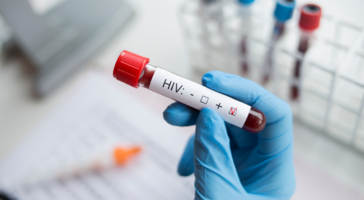 13-anyos, pinakabatang nagpositibo sa HIV sa Palawan