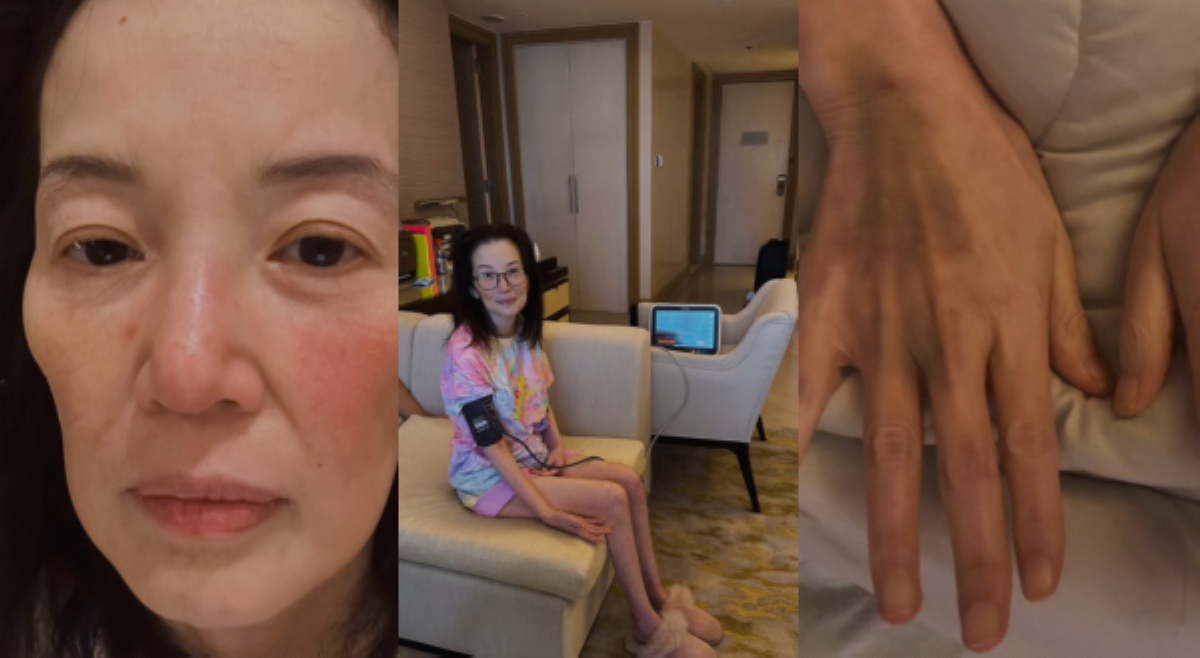 Kris Aquino, may lupus flare fever: 'I wanted you to see the pain'