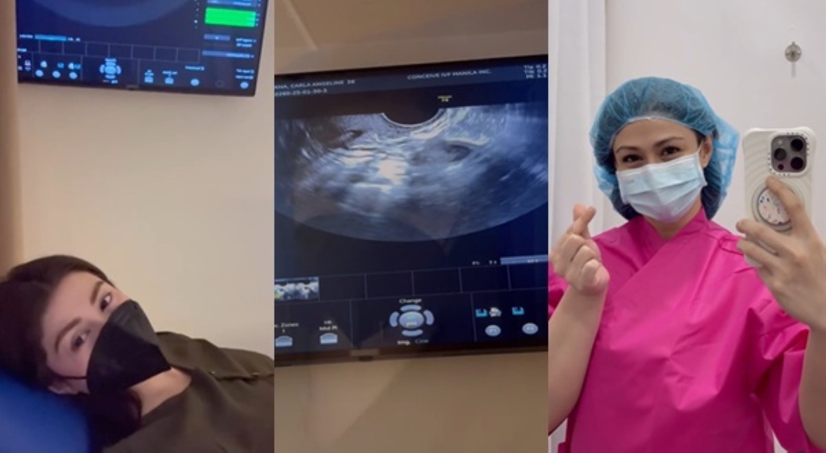 Carla Abellana nagbukas sa publiko na sumailalim sa 'egg freezing'