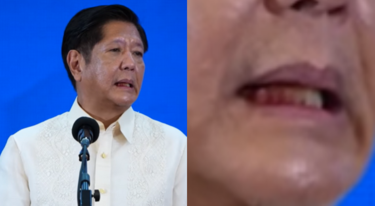 Nakitang 'dugo' sa ngipin ni PBBM habang nagtatalumpati, ikinabahala ng netizens