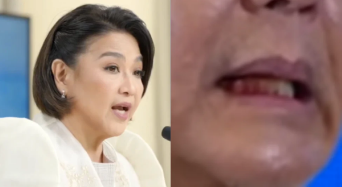 Palasyo, dinepensahan viral 'bleeding gum video' ni PBBM: 'Nothing to worry!'