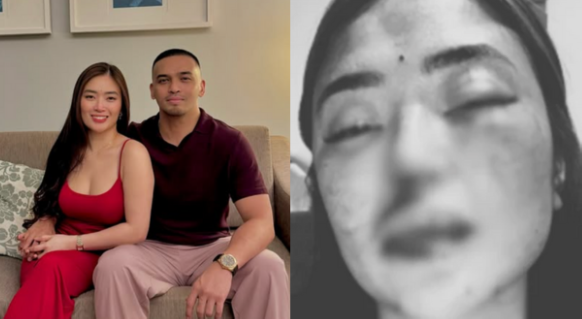 Jam Ignacio at 'binugbog' niyang si Jellie Aw, nagkabalikan daw?