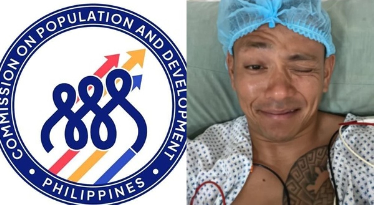 CPD, pinuri si Drew Arellano dahil sa pagpapa-vasectomy