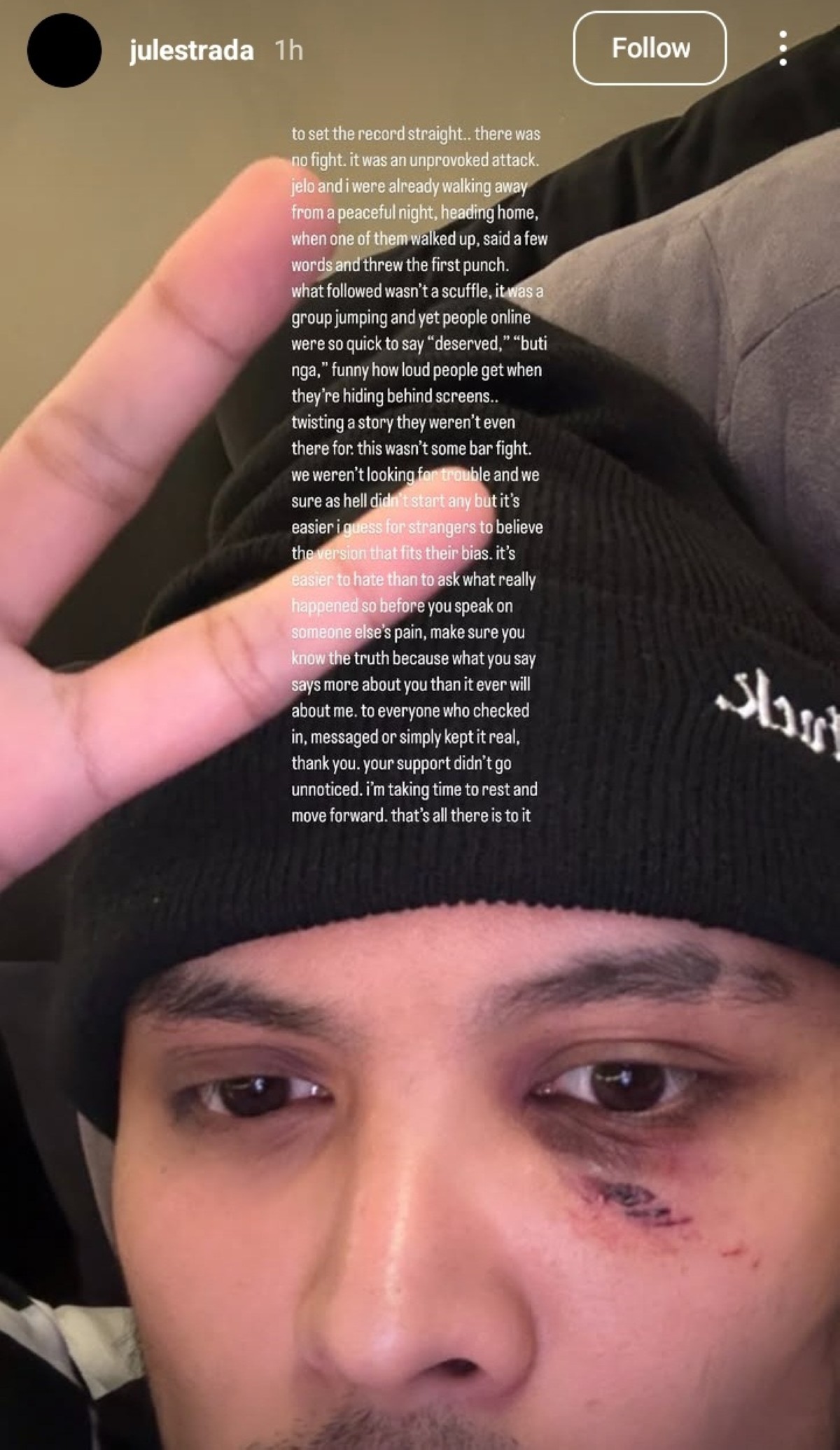 Photo courtesy: Screenshot from Julian Estrada (IG)