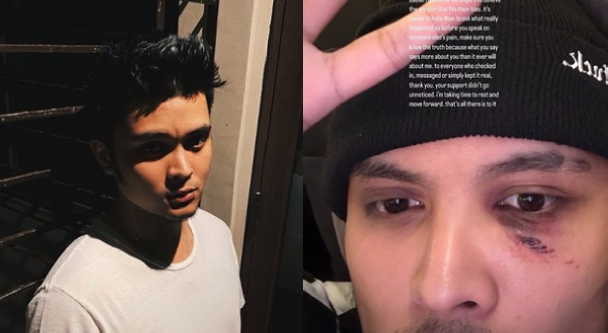 Julian Estrada pumalag; bugbugan sa Boracay, 'unprovoked attack'