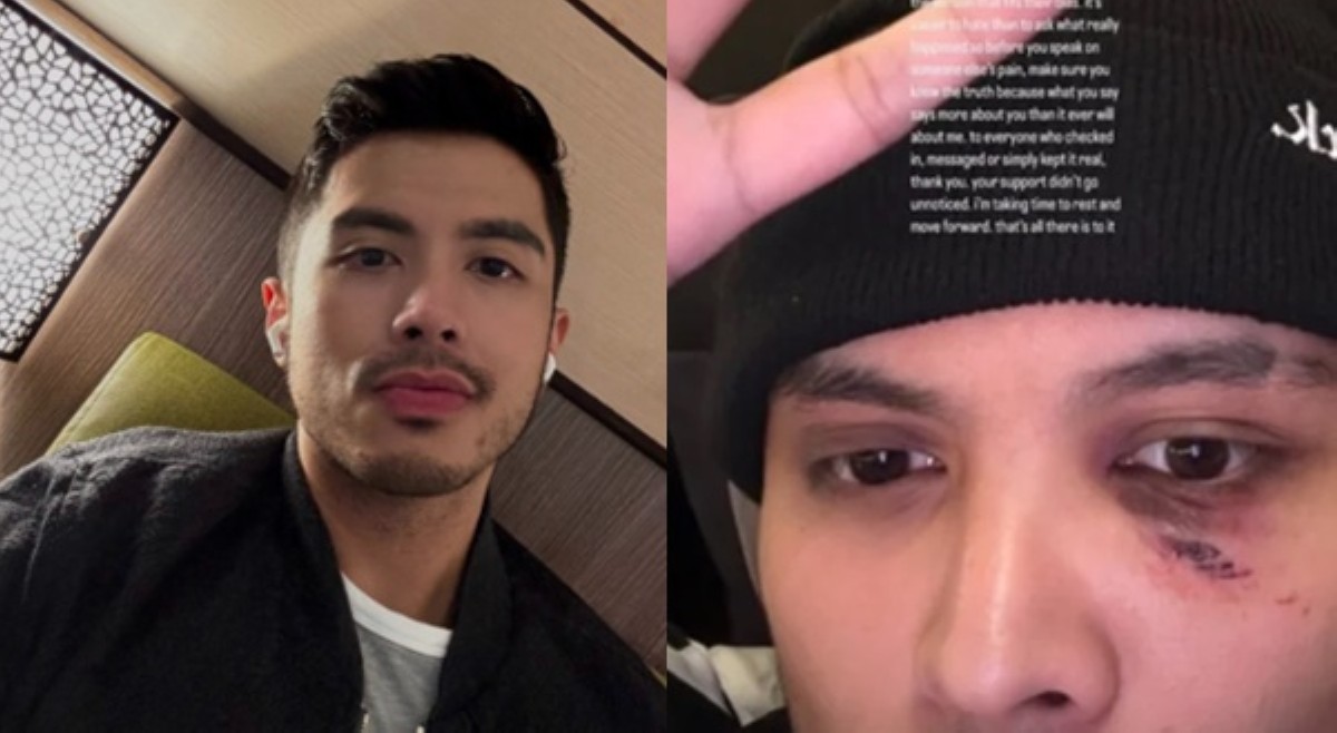Jolo Estrada, dinepensahan ang kapatid na ginulpi