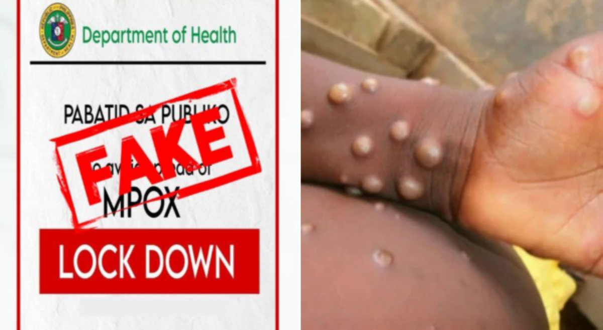DOH, nanawagan kontra fake news; lockdown dahil sa Mpox, pinabulaanan!
