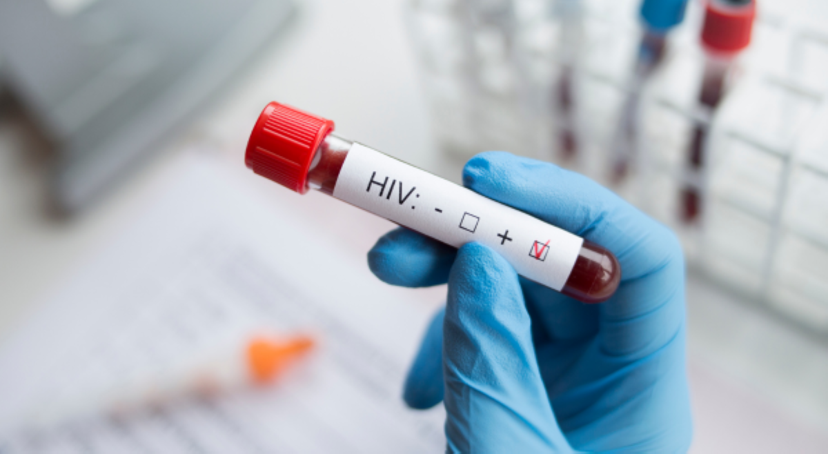 Pilipinas, nangunguna sa buong mundo sa may pinakamabilis na pagtaas ng kaso ng HIV