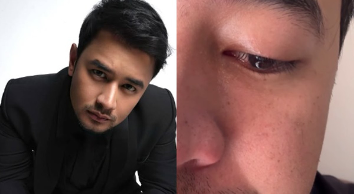 Pag-iyak ni JM De Guzman, pinangambahan