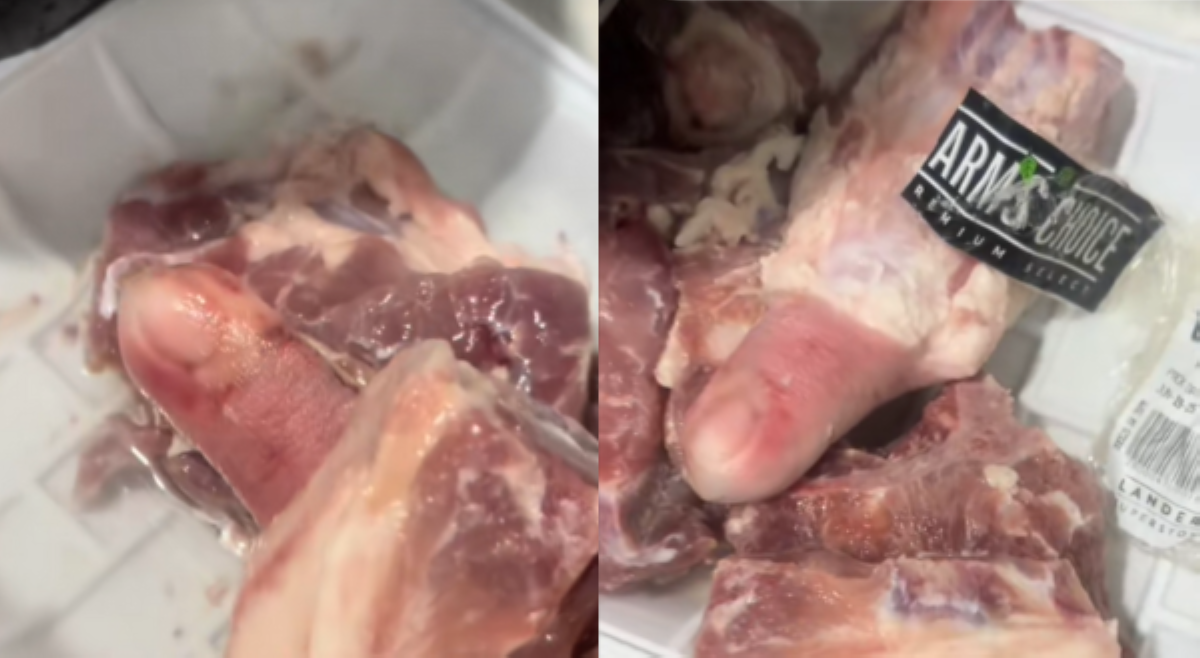 'Buntot daw?' Karne na may daliri umano ng tao, kinuyog ng netizens