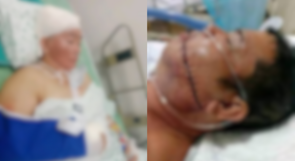 &lsquo;Pinakain pero inatake!&rsquo; 3 lalaki, pinagtataga mag-asawang tumulong sa kanila