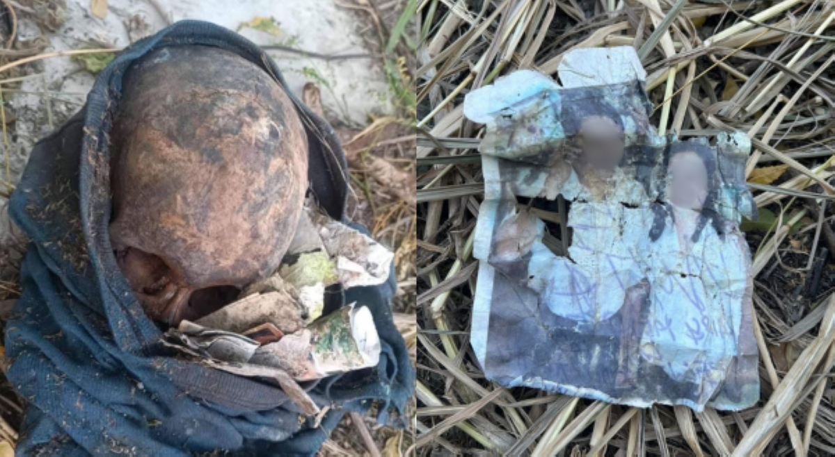 &lsquo;Kinulam?' Bungo ng tao, natagpuang nakabalot sa tela kasama ng karayom at mga larawan
