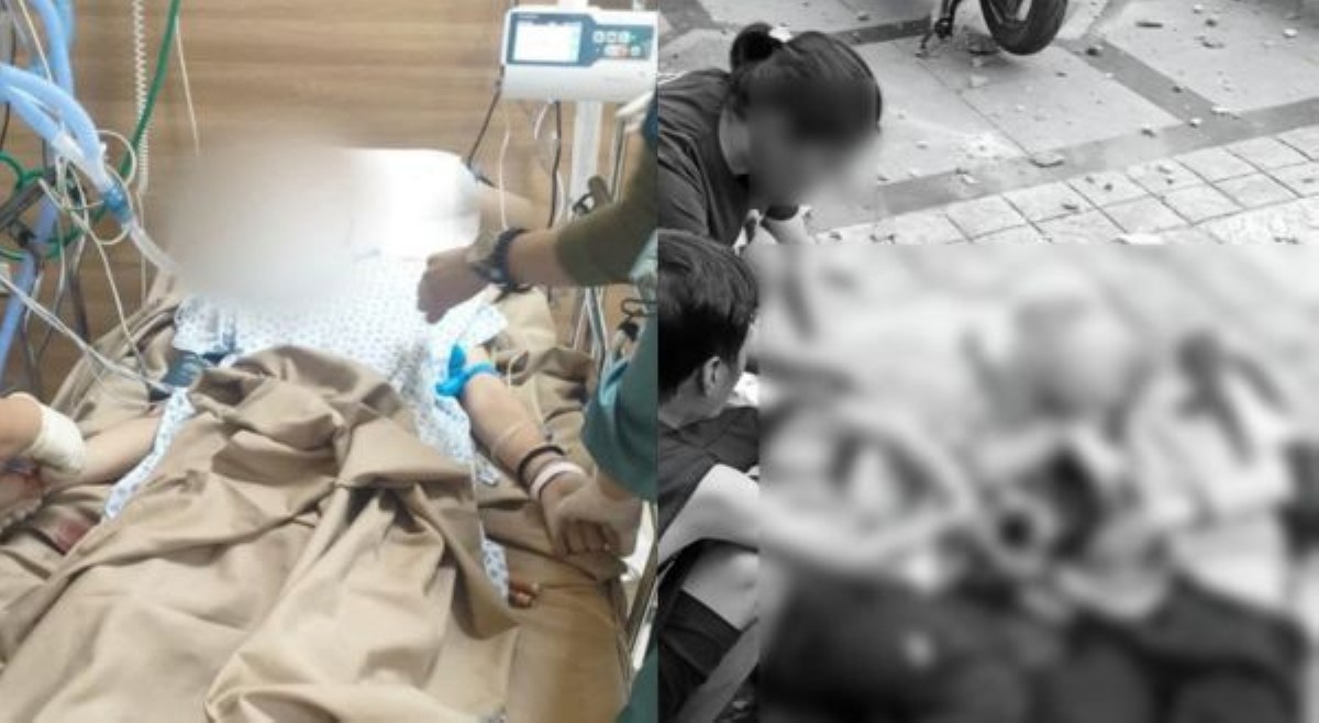 1 sa mga estudyanteng nalaglagan ng debris, matagumpay ang operasyon