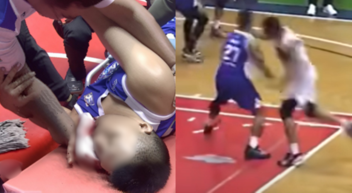 &lsquo;Dinaan sa suntok!&rsquo; Basketball player, binasag panga ng kalaban