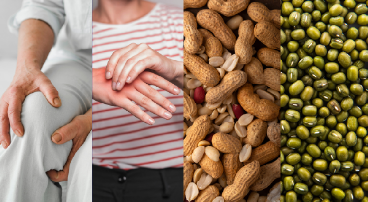 ALAMIN: Totoo bang bawal sa may uric acid at gout ang munggo, beans, at mani?