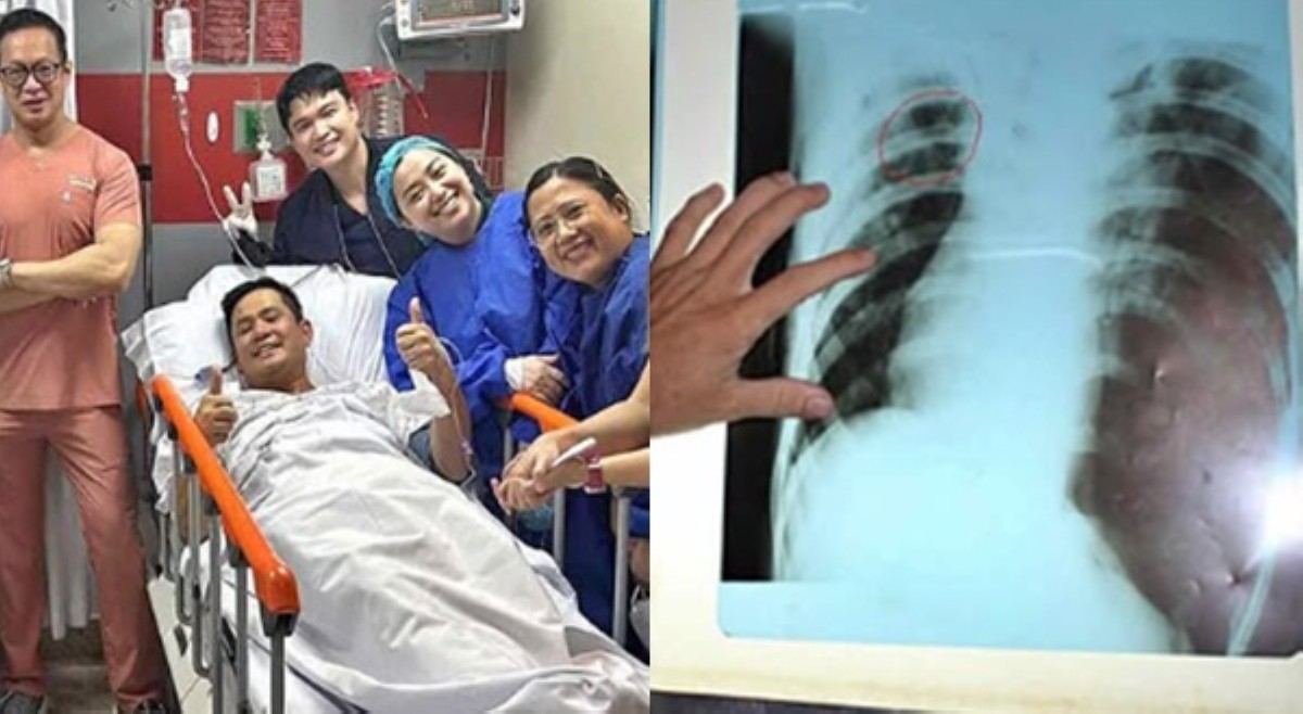 Ogie Alcasid, pinabulaanang may lung cancer siya