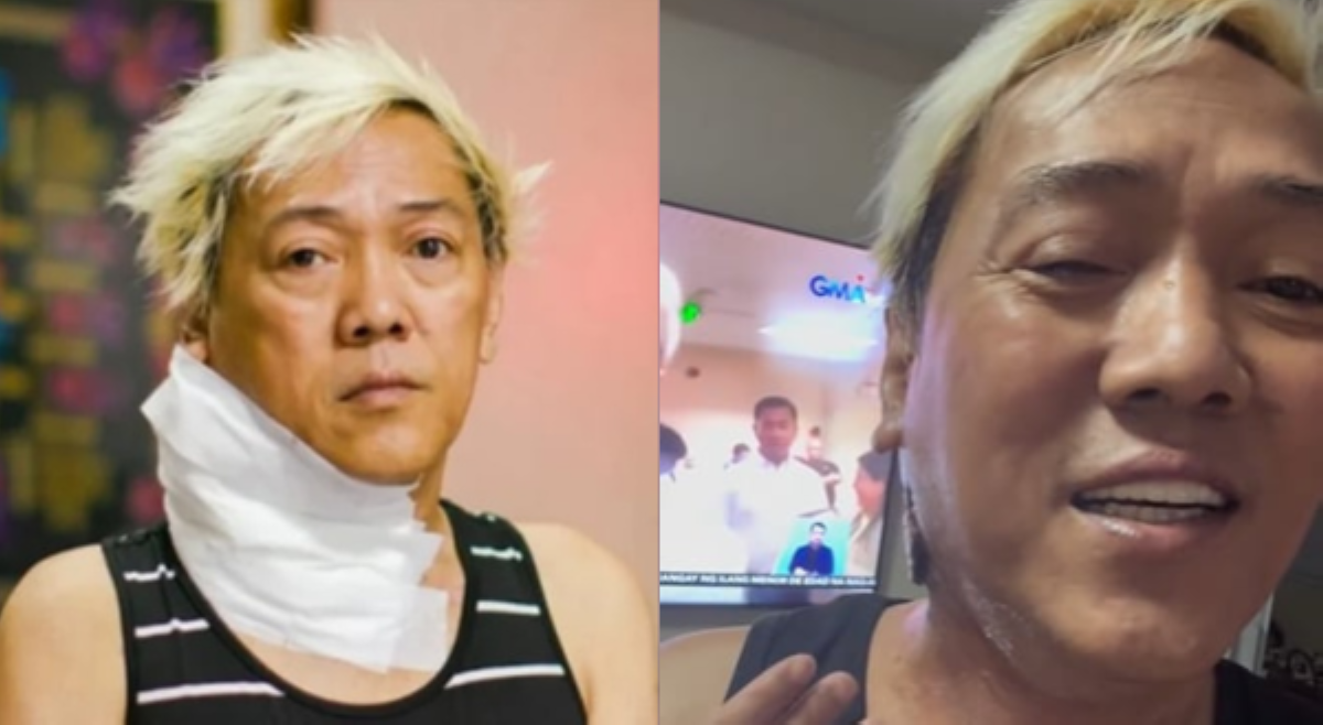 'Kaunting-kaunti na lang!' Ate Gay, pinagpasalamat patuloy na pagliit ng kaniyang bukol