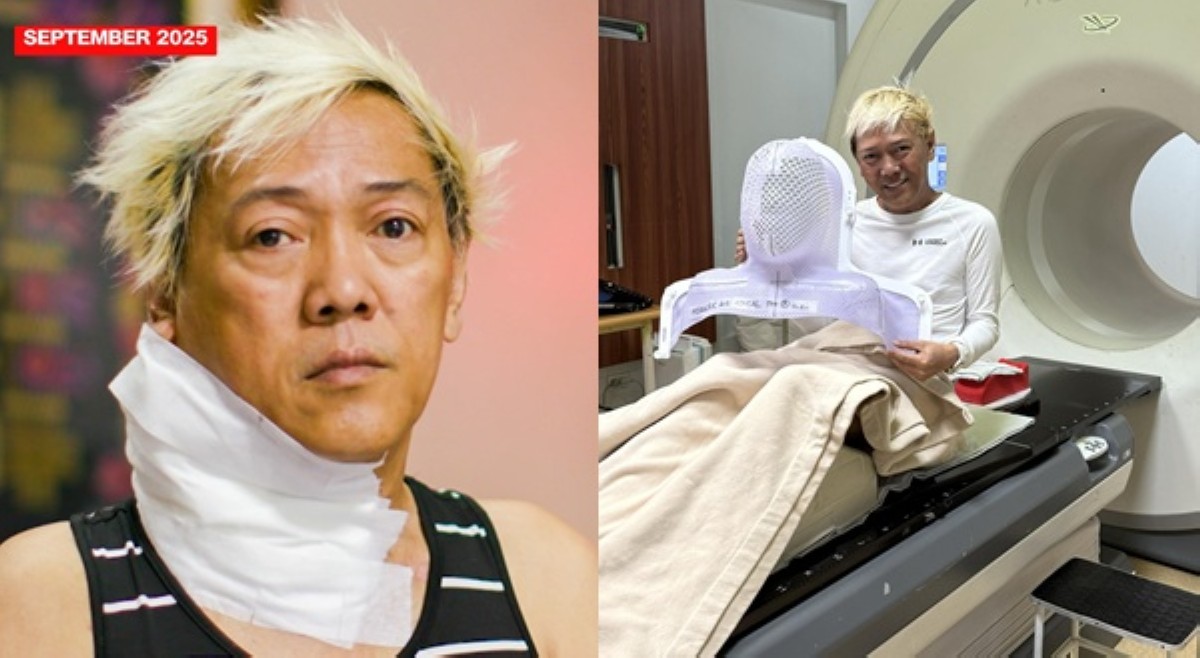 'May himala!' Bukol ni Ate Gay sa leeg, umimpis na