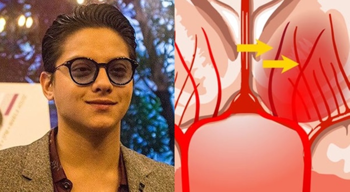 Daniel Padilla tatamaan ng mild stroke, sey ni Rudy Baldwin