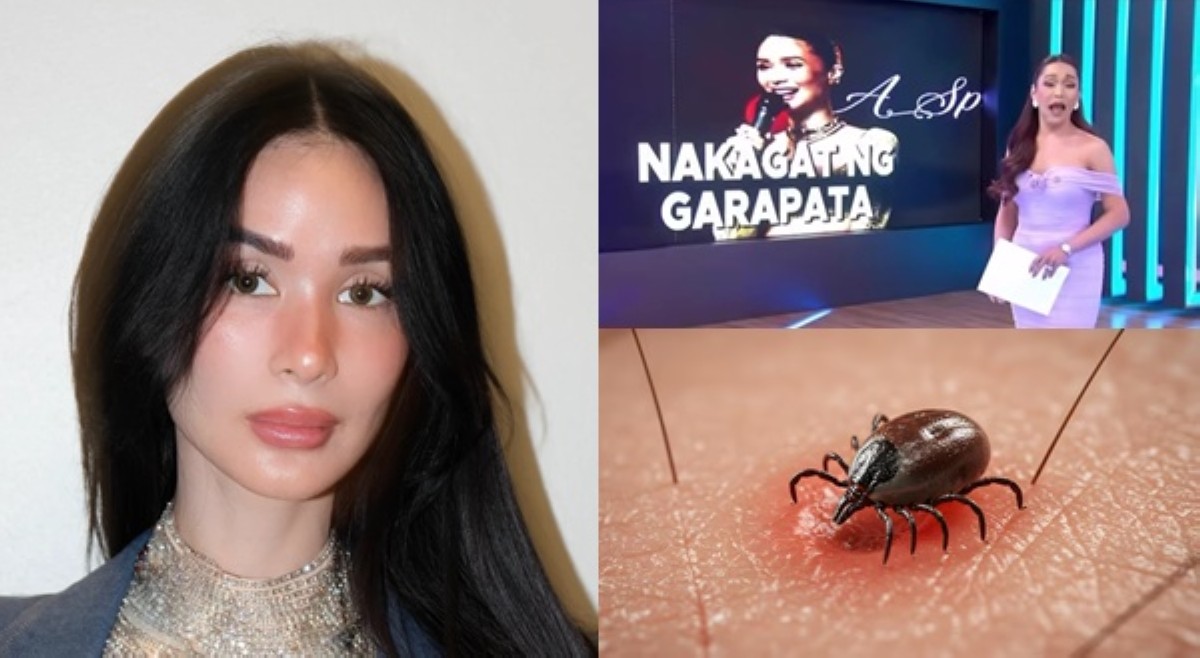 Heart natawa na lang; pagkagat ng garapata sa kaniya, ibinalita pa!