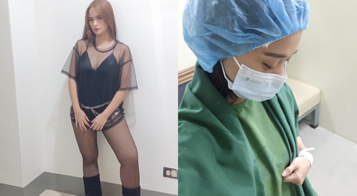 Matapos mapuruhan ang ulo: Jopay inoperahan naman ang tuhod!