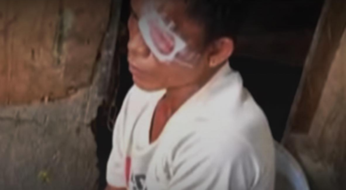E-trike driver, muntik mabulag matapos kagatin sa mata ng kapuwa driver