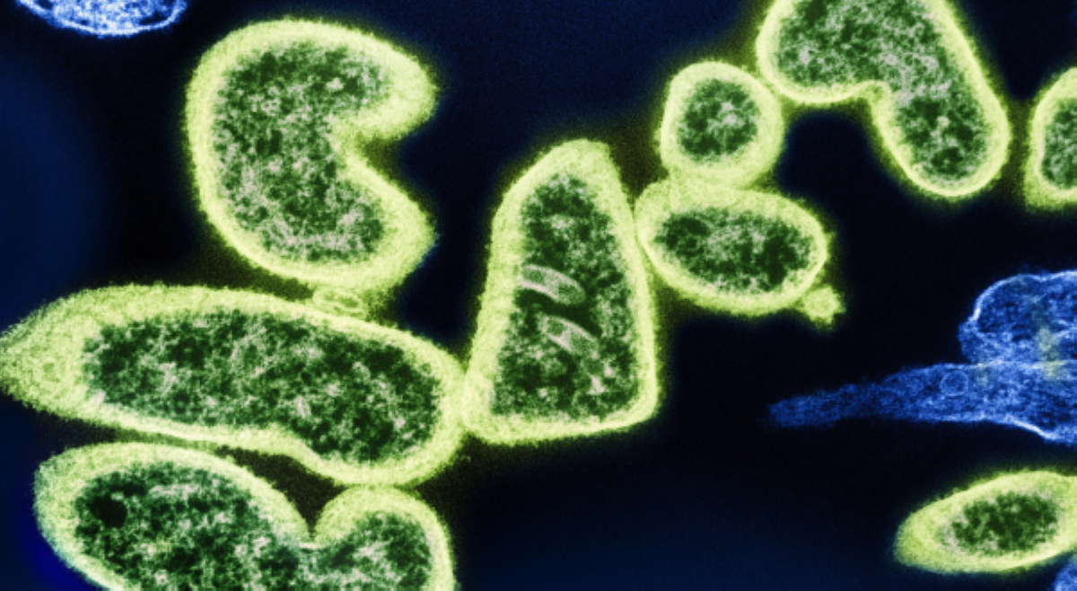 ALAMIN: Ano ang kumakalat na &lsquo;Nipah Virus&rsquo; sa iba&rsquo;t ibang bansa?