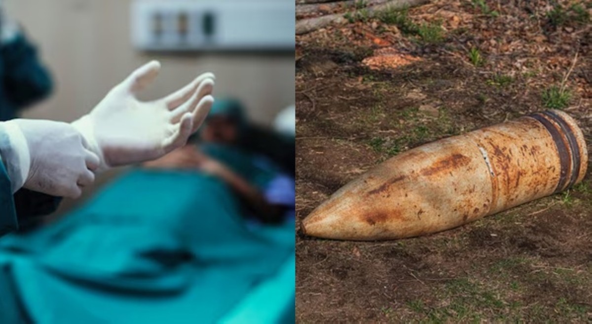 Ospital, nabulabog! Pahabang bomba noong World War I, nakatusok sa wetpaks ng lalaki