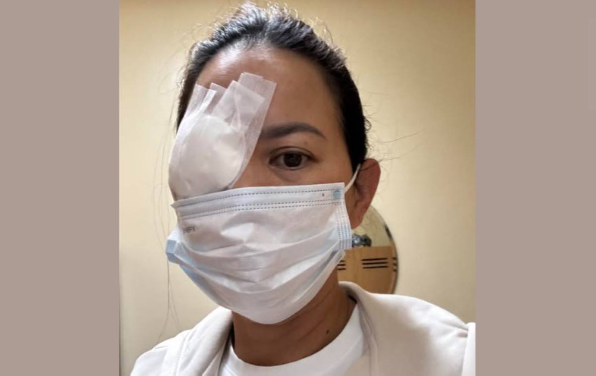 'Ouch!' Andrea Del Rosario, sumailalim sa minor surgery dahil sa pekeng lashes