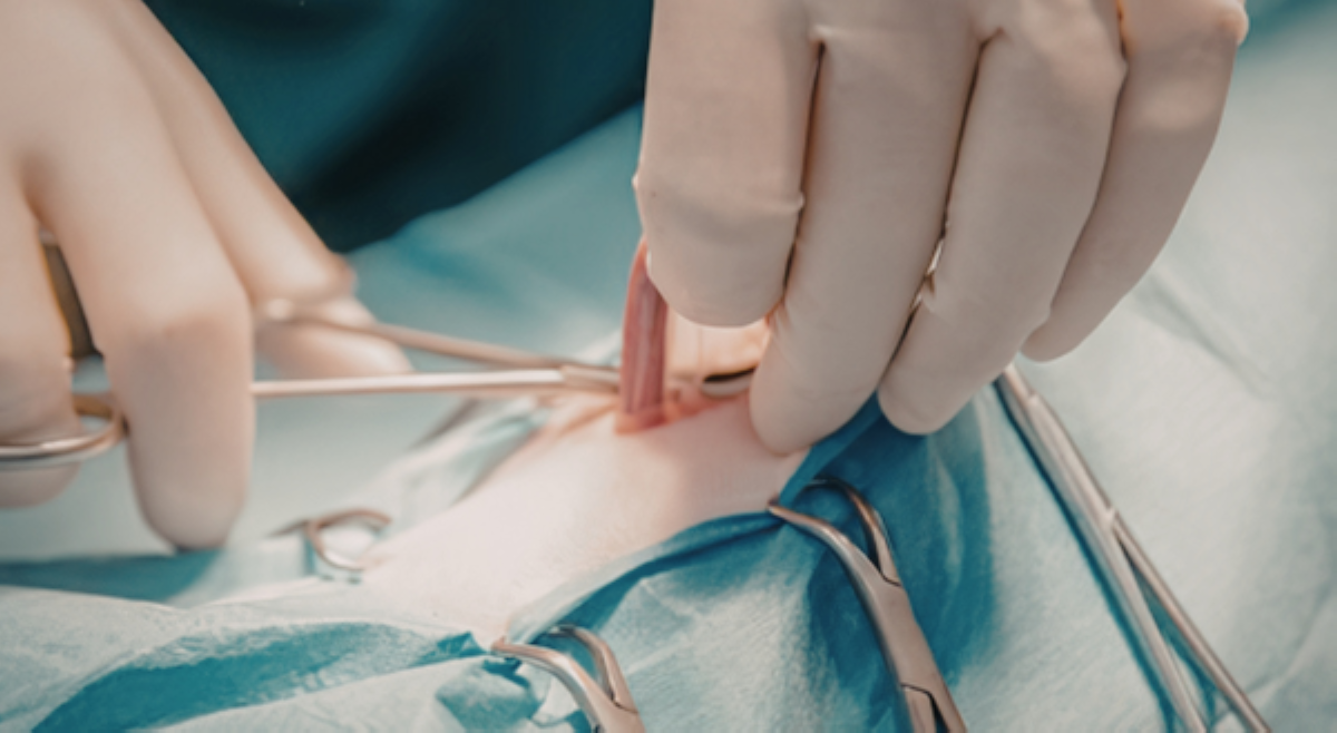 &lsquo;Iba ang naputol!' Doktor na nagkamali sa kidney operation ng isang senior citizen, hinatulan!