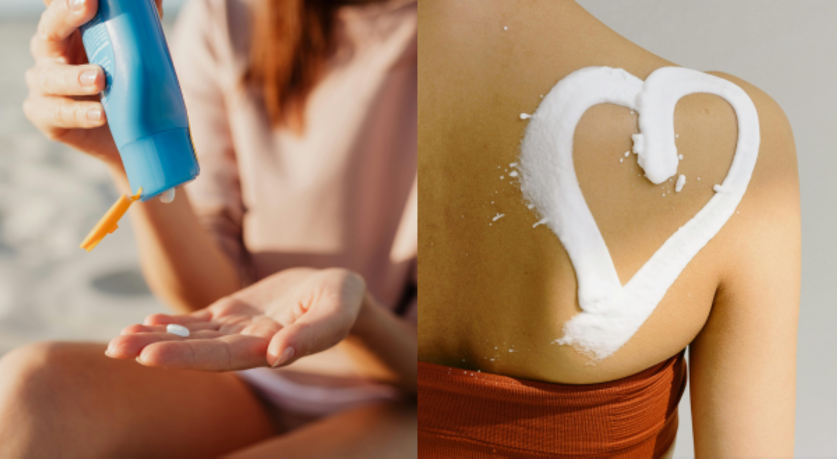 ALAMIN: Ano ang recommended sunscreen SPF para maiwasan pagkasunog ng balat sa araw?