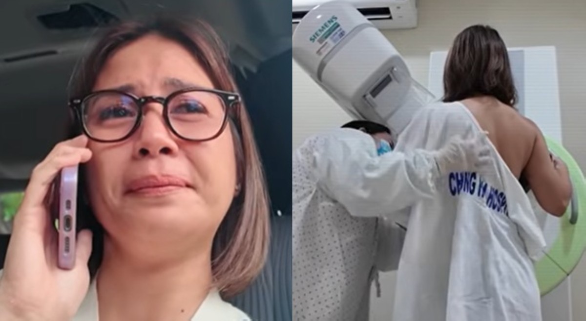 Survivor na! Kaye Abad nanggulat, ibinahagi ang breast cancer journey niya