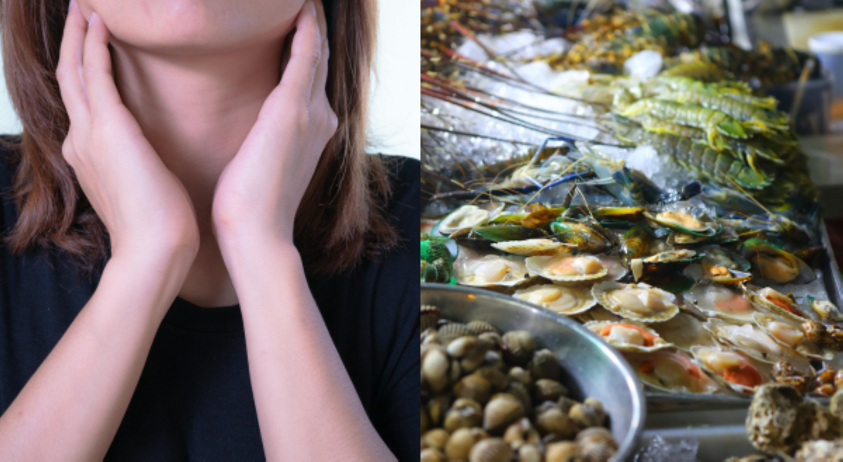 Totoo bang nakatutulong ang seafood para sa kondisyon ng thyroid?