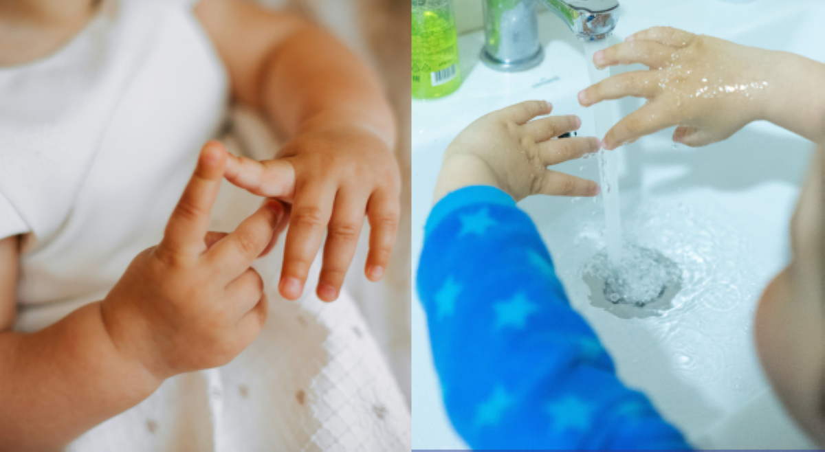 QCESD: 74% ng HFMD cases sa QC, binubuo ng mga batang edad 6 pababa!