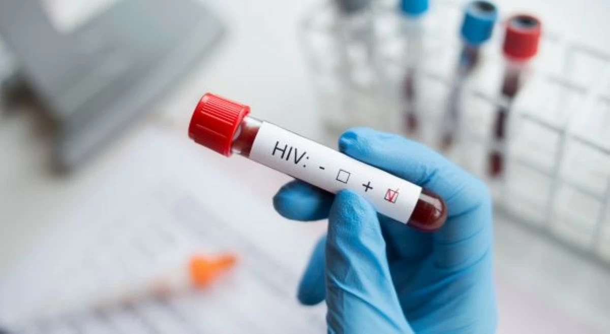 HIV cases sa bansa, pumalo na ng mahigit 4,000 sa 1st quarter ng 2026!
