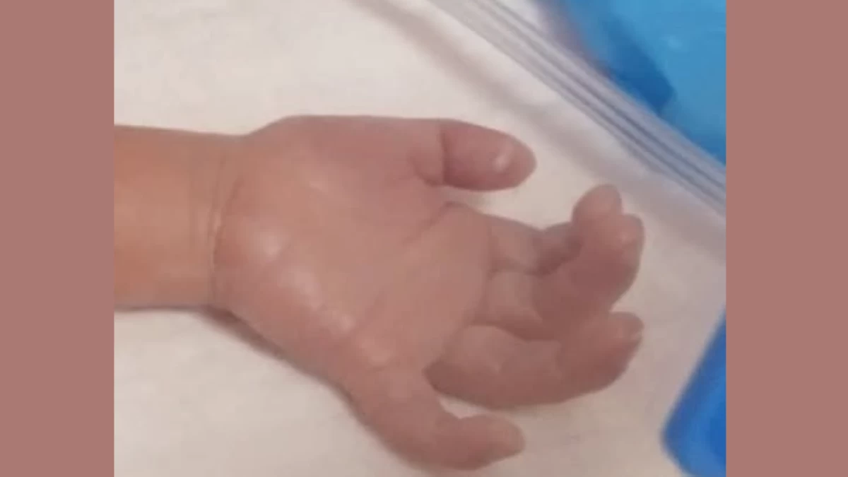#BalitaExclusives: Hinagpis ng bagong panganak na first-time mom dahil sa hospital bill, kinaantigan