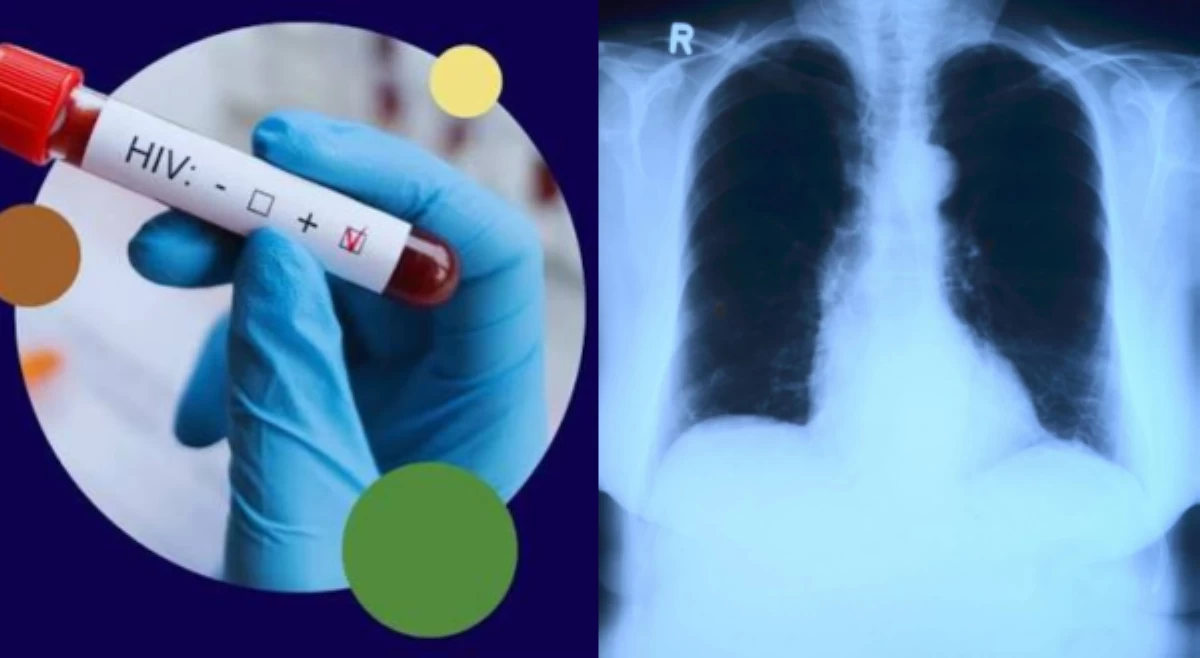 ALAMIN: Paano malalabanan ang mga sakit na HIV, tuberculosis?