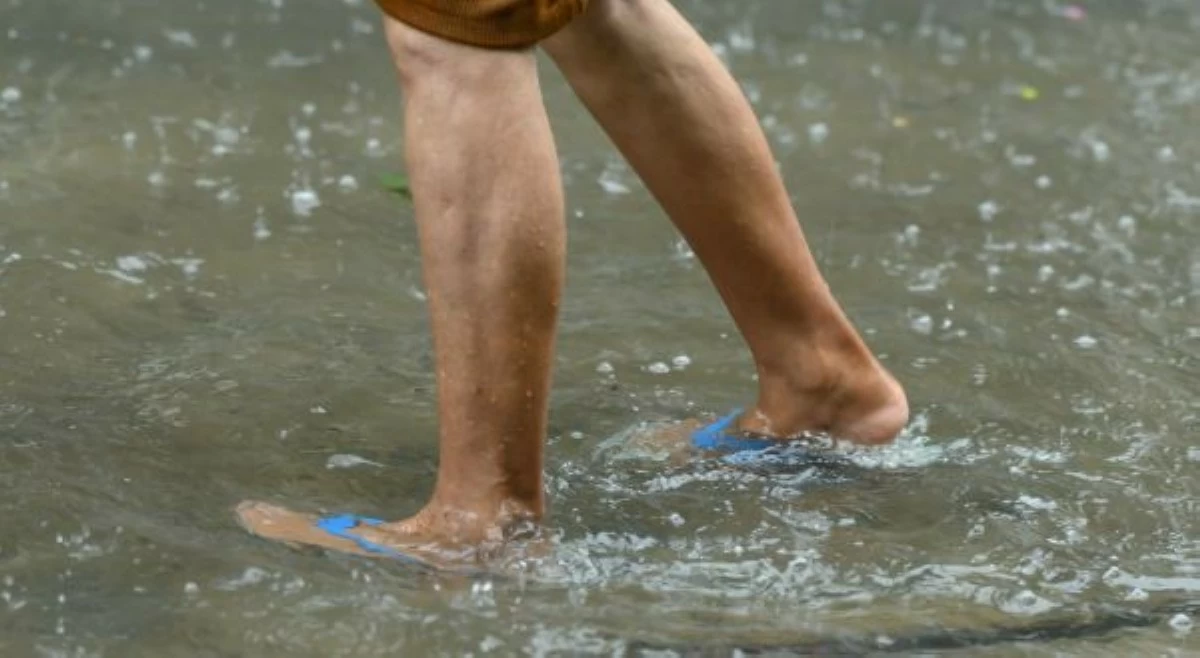 'Kahit walang sugat!' Eksperto, nagbabala hinggil sa leptospirosis!
