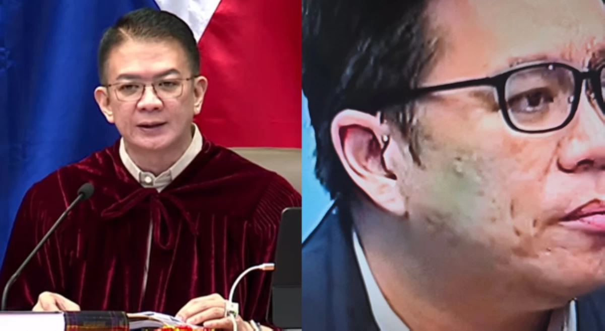 'It was an AI!' Escudero, nilinaw na walang suot na 'earpiece' ni Ortonio