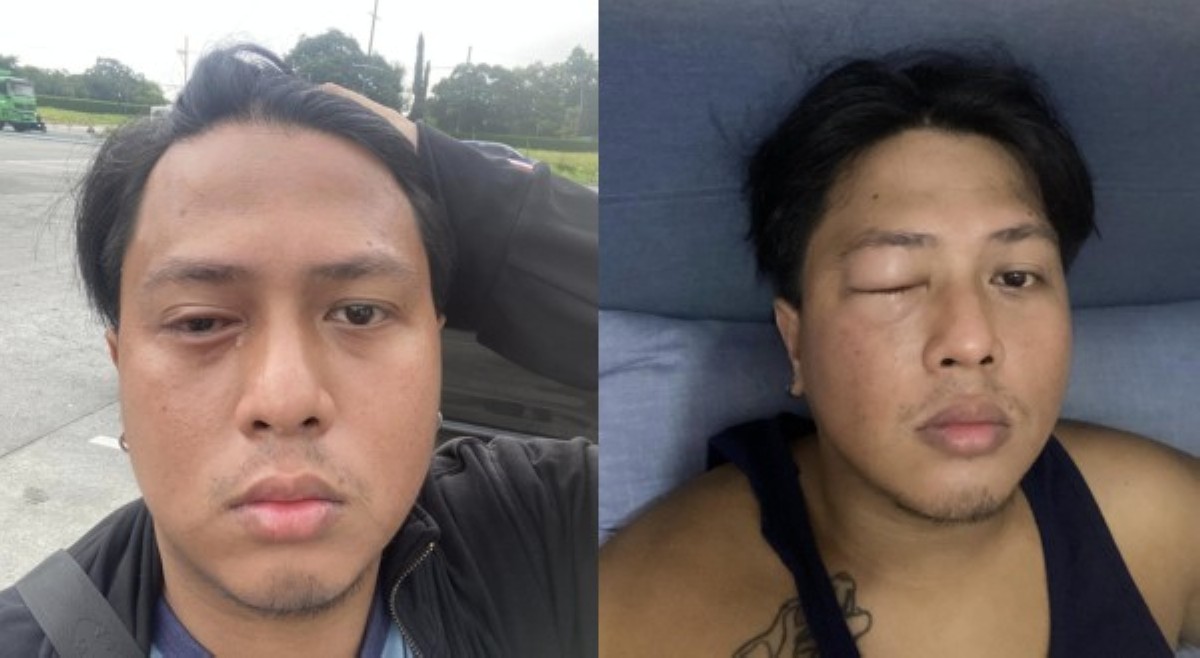 <b>Netizen na naapektuhan umano ng vog, nagbigay-babala sa publiko</b>