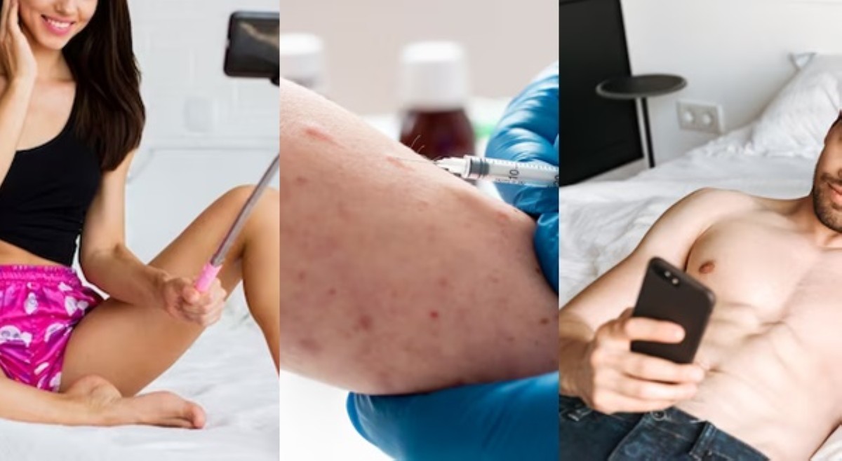Payo ng DOH na vidyokol muna sa sex para iwas-mpox, umani ng reaksiyon