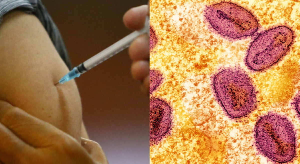 DOH, nagbabala vs. imported Mpox vaccines