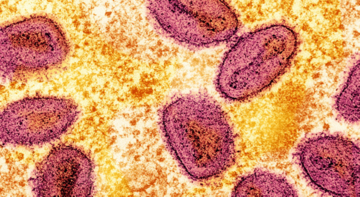 DOH: Kumpirmadong kaso ng mpox sa 'Pinas, 18 na