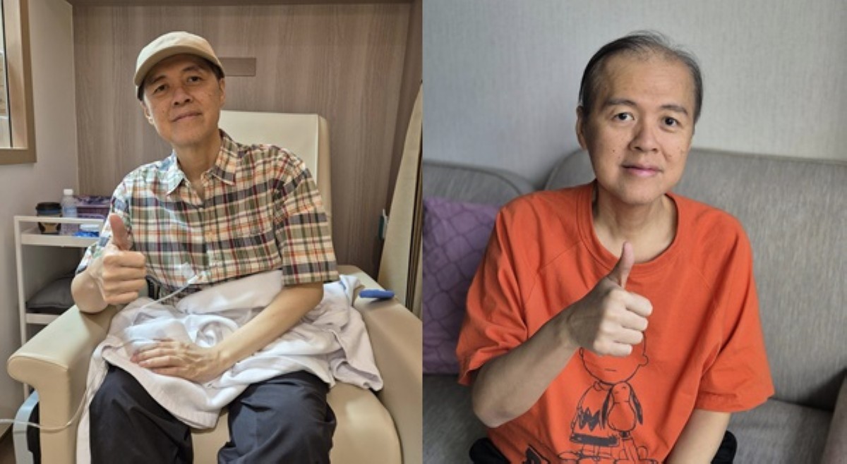 Doc Willie tapos na sa 1st round ng chemo: 'Pasensya na wala na 'kong buhok...'